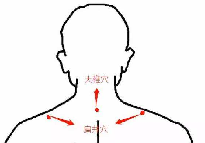 按肩井穴對(duì)頸椎病有效嗎
