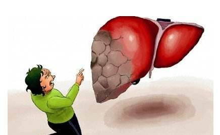 頭部出現(xiàn)這4種狀況，就要注意你的肝了！